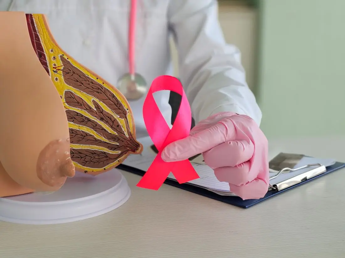 Modelo de representação da anatomia da mama para explicar líquido amarelo saindo da mama ao apertar.