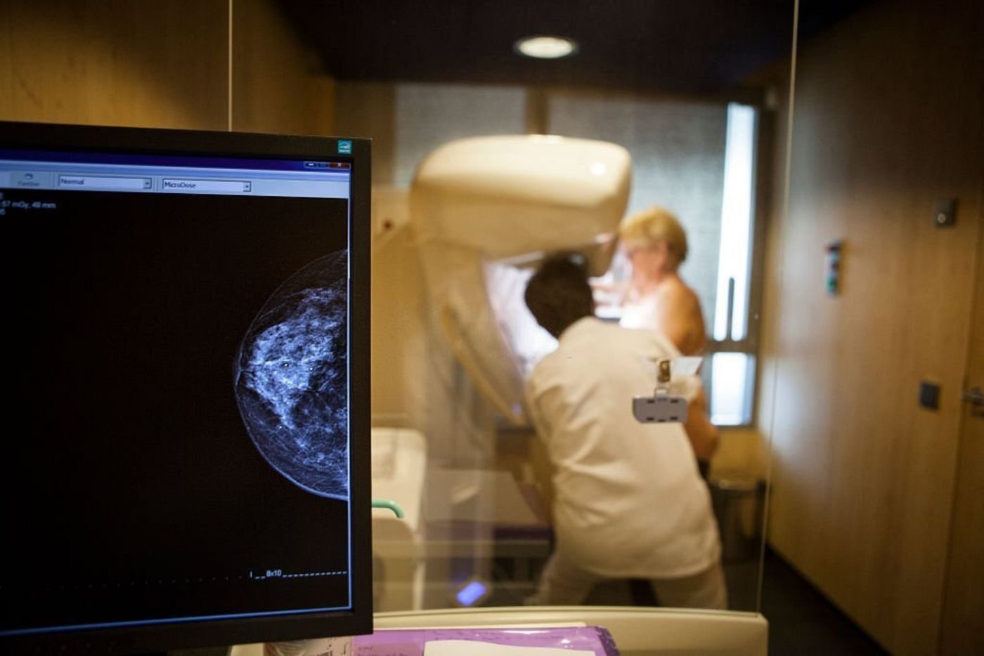 Paciente em exame em máquina para detectar câncer de mama luminal b e o prognóstico.